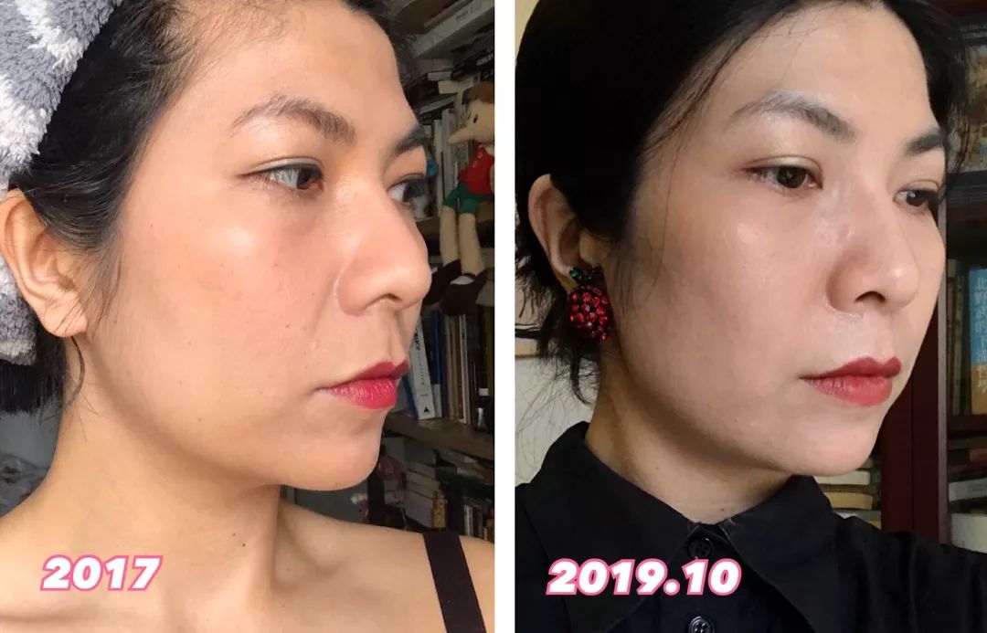 推广一个月没有任何效果,美容院脸部抗衰提拉紧致手法