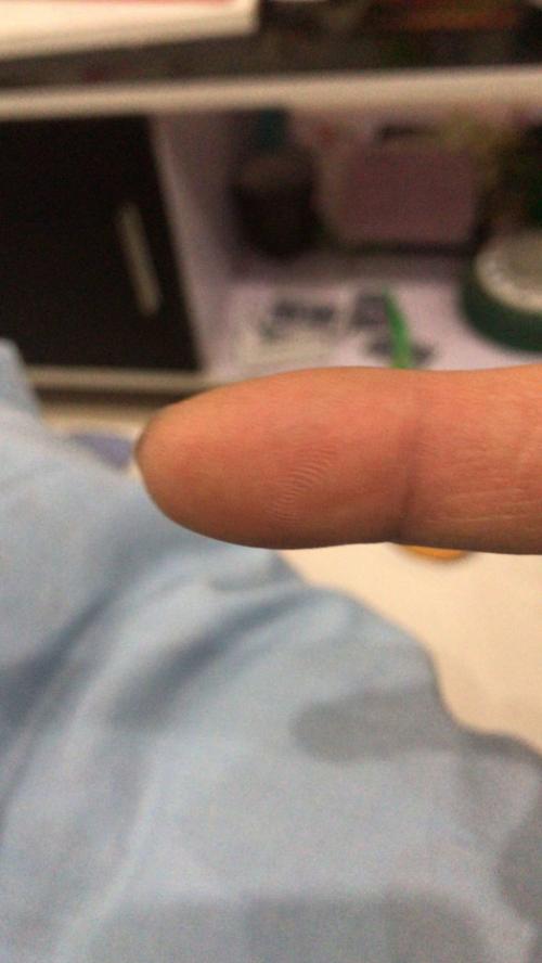 一个九江人的隔离日记：病毒就在我身边——满庭春小区17栋疫区封楼纪实