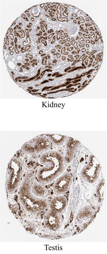 新冠病毒能让男性不育吗,新冠病毒会不会引起男性不育