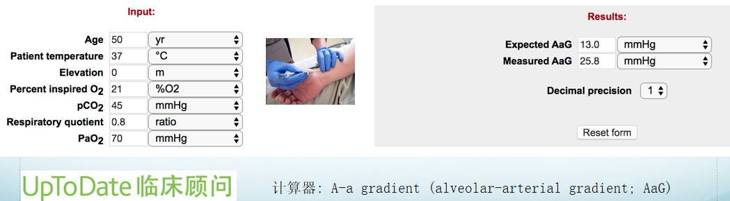 肝硬化肝肺综合征一般活多久,肝性脑病是肝硬化最严重的并发症