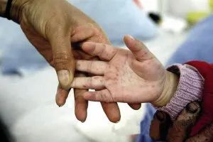 手足口病的预防与护理温馨提示,预防手足口病的演讲稿