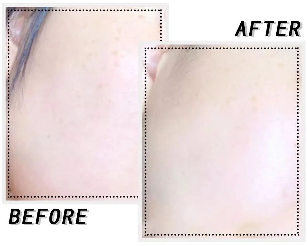 女明星逆龄的秘密,女明星惊天大反转