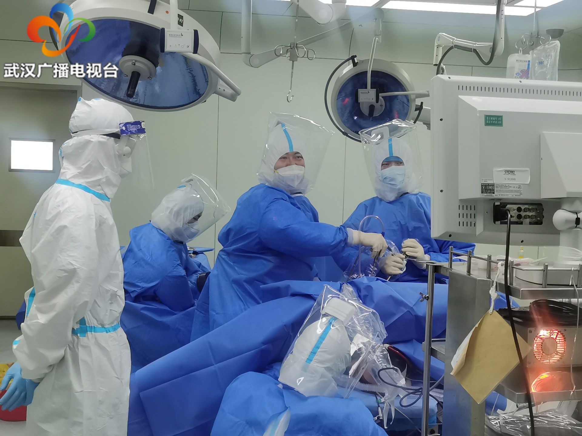 危重症新冠肺炎患者肺大泡破裂生命垂危医生在充满病毒气溶胶的手术室实施“补肺”手术