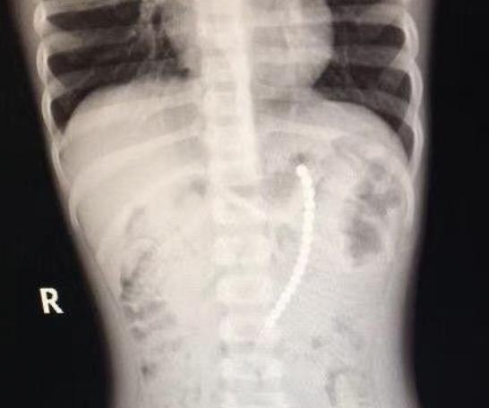 鍧戜汉鐜╁叿鎺ㄨ崘,涔扮帺鍏峰墠涔扮帺鍏峰悗