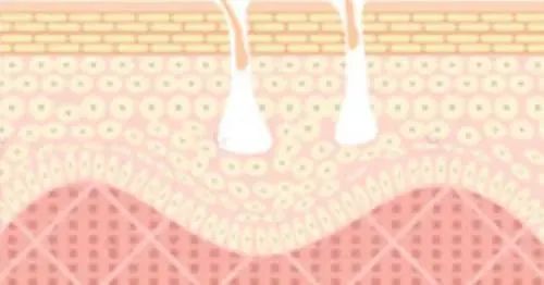 嘴唇干裂起皮等皮掉了涂唇膏,嘴唇干脱皮用什么唇部护理比较好?