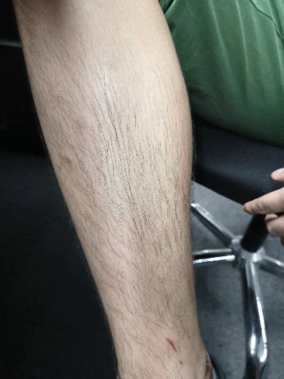 有没有一款真正永久脱毛的脱毛膏,你还在用剃须刀刮胡子吗