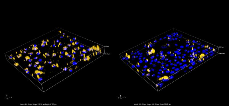 小红书祛斑美白方法,小红书推荐美白护肤品