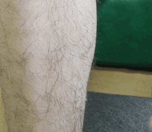 光滑无暇|黑丑的“毛裤腿”，用它，10分钟“脱”得一干二净，肌肤光滑细腻