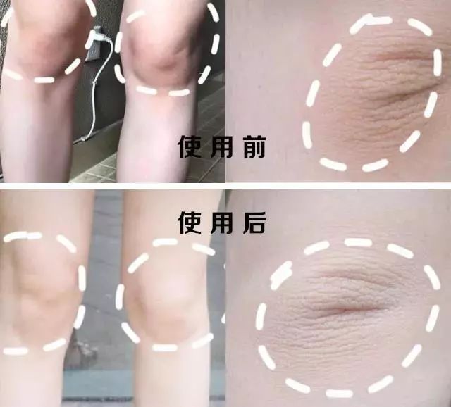 20天白到发亮,15天快速美白