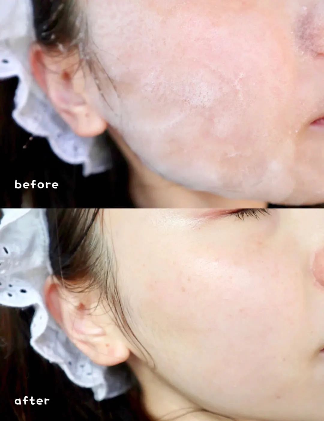 洗出脸上的脏东西解压,清除脸上斑块的产品