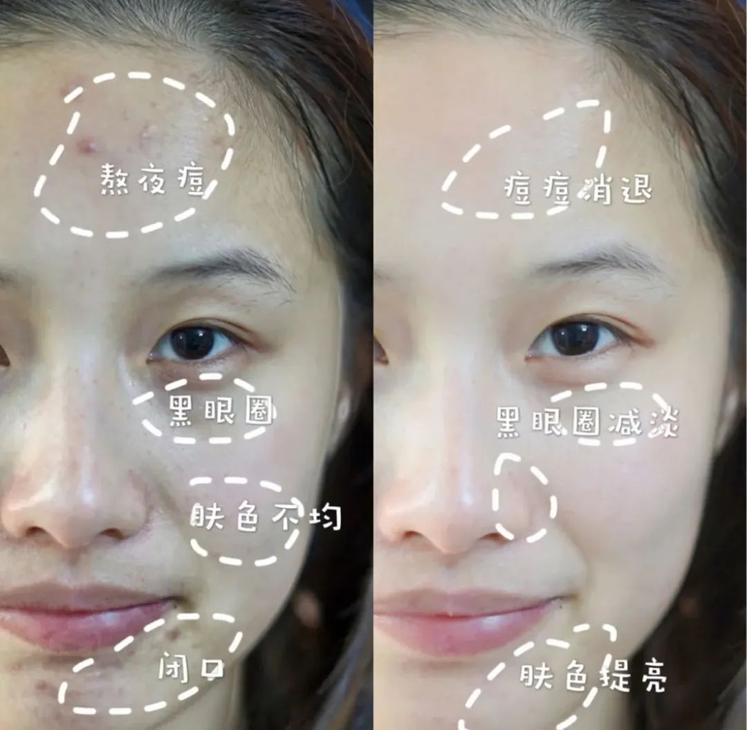 洗出脸上的脏东西解压,清除脸上斑块的产品