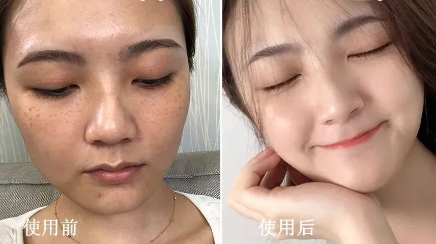 angelababy30岁素照,angelababy早期日本照