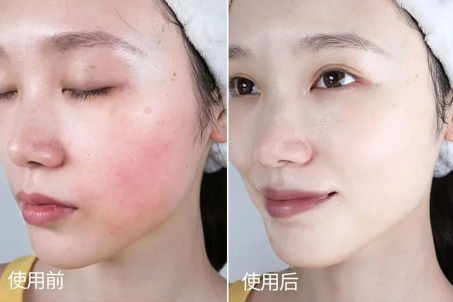 angelababy30岁素照,angelababy早期日本照