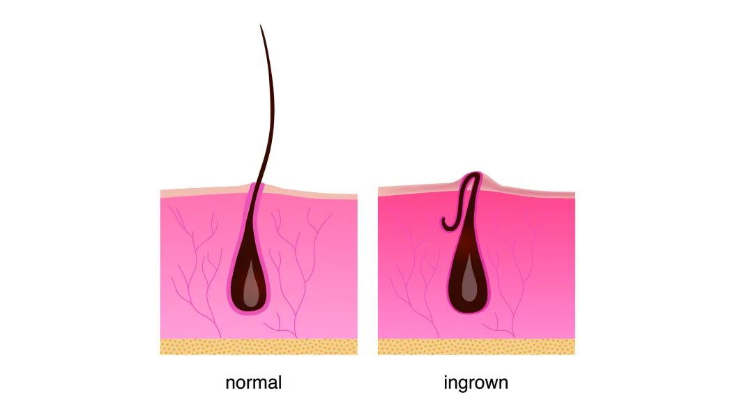 女生为什么大热天穿长袖,夏天到了为什么女生喜欢穿热裤
