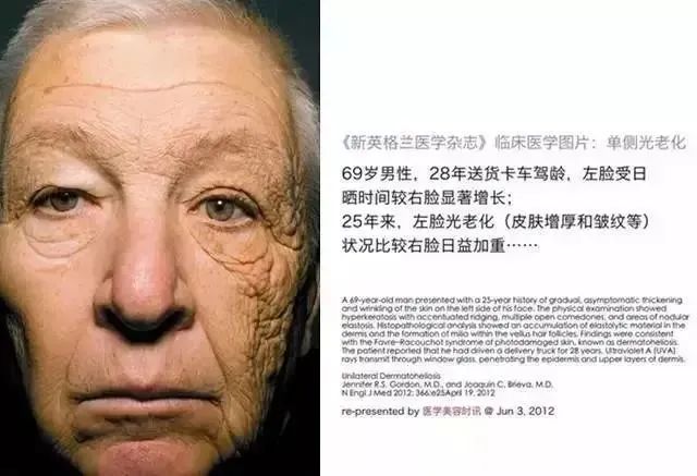 日本防晒帽孙俪,孙俪同款日本防晒帽哪个颜色好看