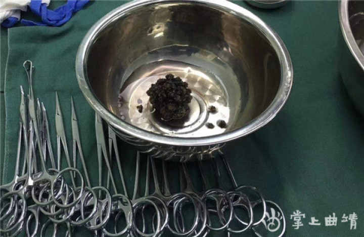 县人民医院泌尿外科什么水平,曲靖人民医院泌尿科专家门诊