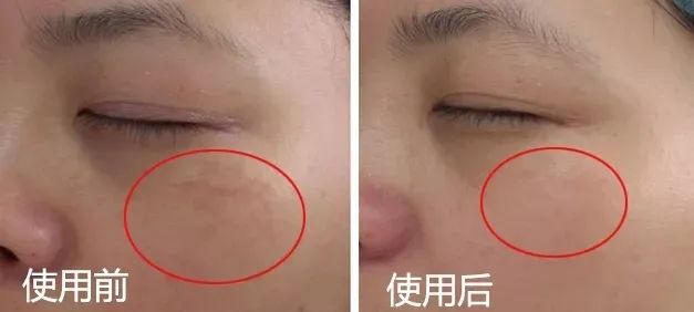 长期补充胶原蛋白的人怎么样了,长期喝胶原蛋白的人最后怎么样了