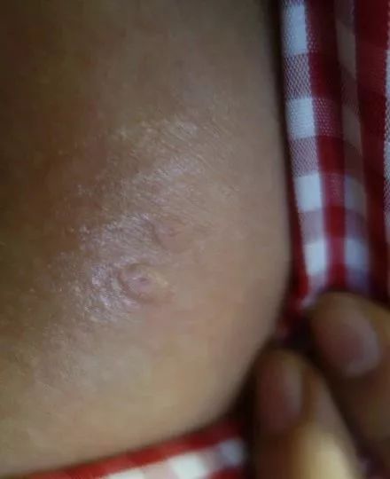 屋里白色小飞虫咬人,家里好多黑色的带壳小飞虫咬人吗