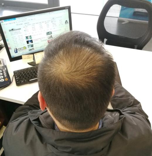 转！广西数十万人关注的爱发活动，助你远离脱发秃顶困扰