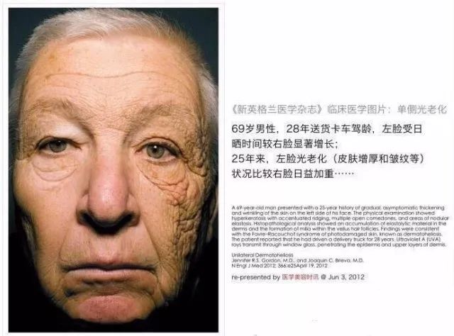 泰国人用什么防晒,泰国人参防晒