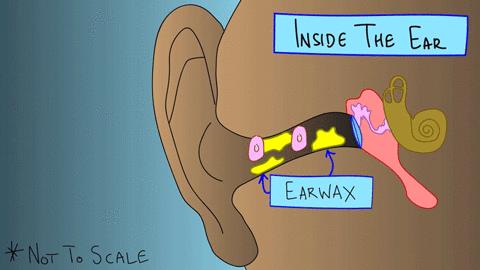 棉签抠耳朵导致癫痫,警惕掏耳朵竟暗藏这些危险