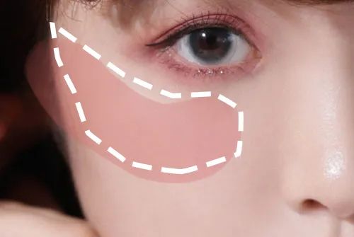 周雨彤泪沟神器,周雨彤的泪沟神器