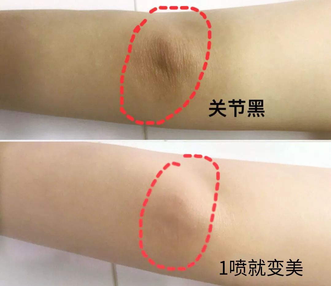 为什么夏天不露腿了,夏天不露腿热吗