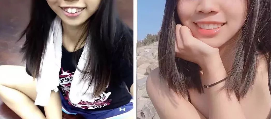 好羡慕别人有一口好牙齿,早日拥有一口整齐更漂亮的牙齿