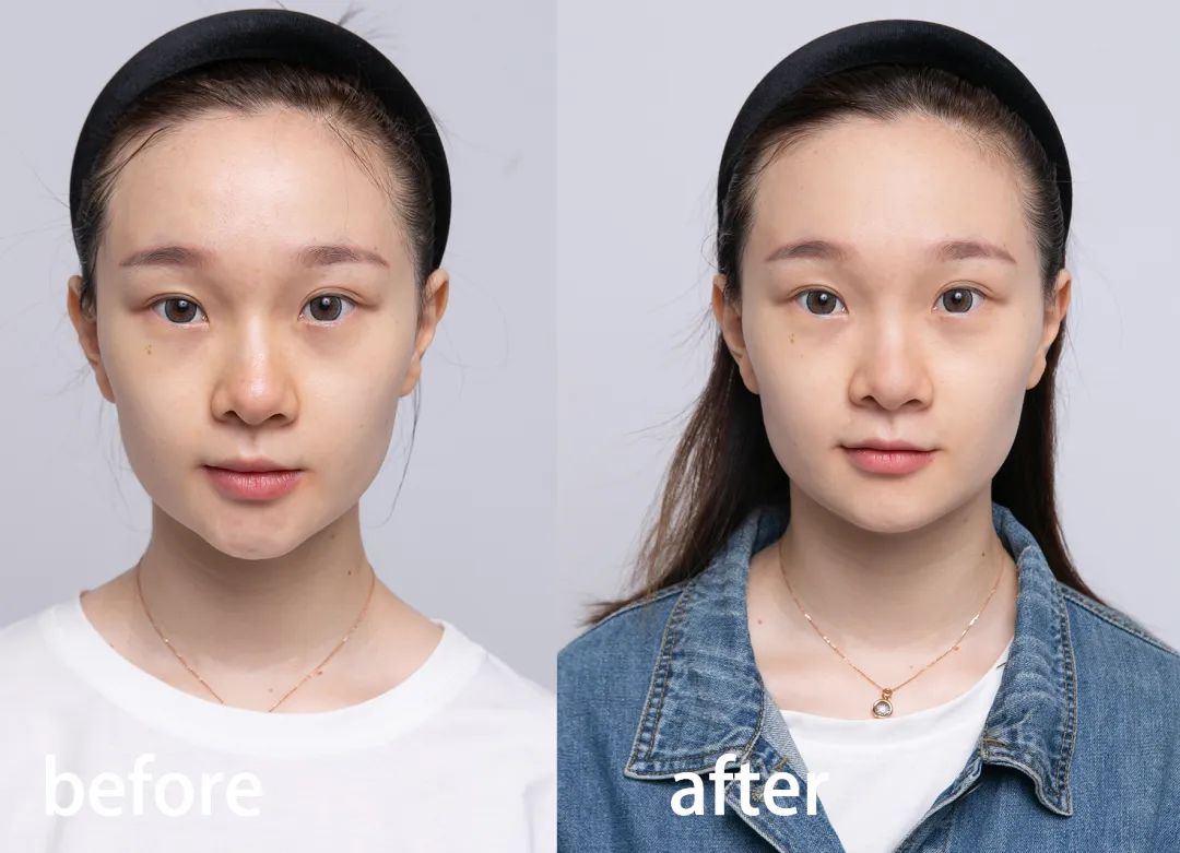 黄金美容真相,黄金美容护肤