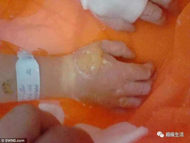 全球十大危险有毒动物,加拿大毒虫名单