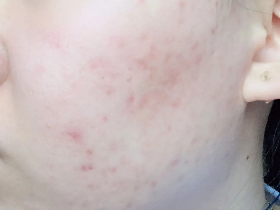 百人测评团|蒸笼天里，想让肌肤“一秒入水”，可能吗？