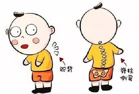 孩子弯腰驼背高低肩,孩子弯腰驼背体态难看