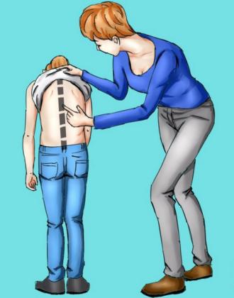 孩子弯腰驼背高低肩,孩子弯腰驼背体态难看