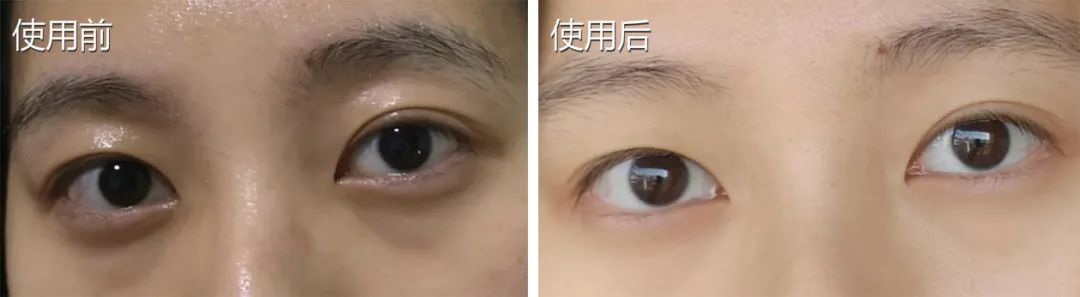 国货眼霜马应龙八宝,马应龙去黑眼霜官方旗舰店