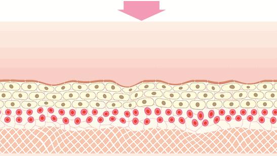 一条颈纹老十岁教你一招淡化,女人脖子有颈纹和年龄有关吗