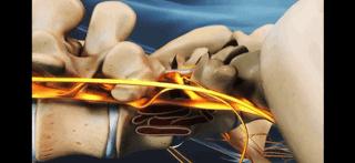 腰痛的真正原因是什么,腰痛要警惕五种原因