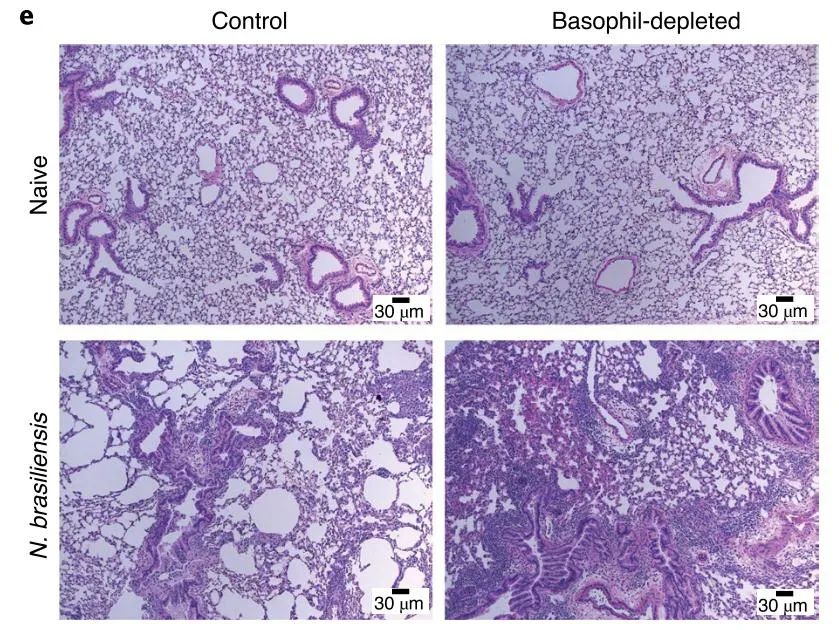 蠕虫病怎么治疗效果好,蠕虫感染的特点