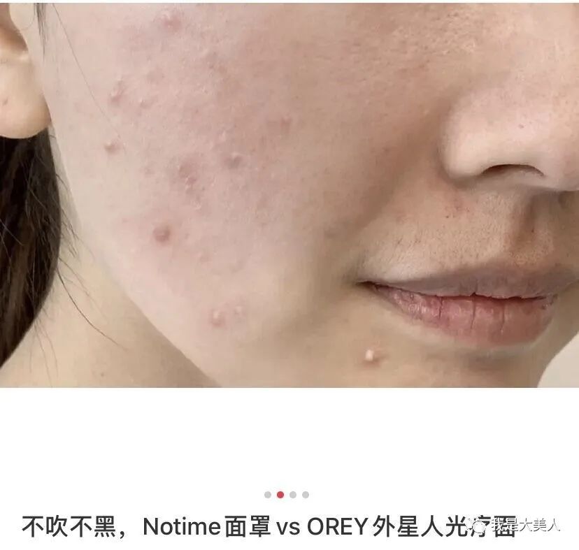 这个黑科技口碑人气王，只要10分钟让你有面膜的使用感