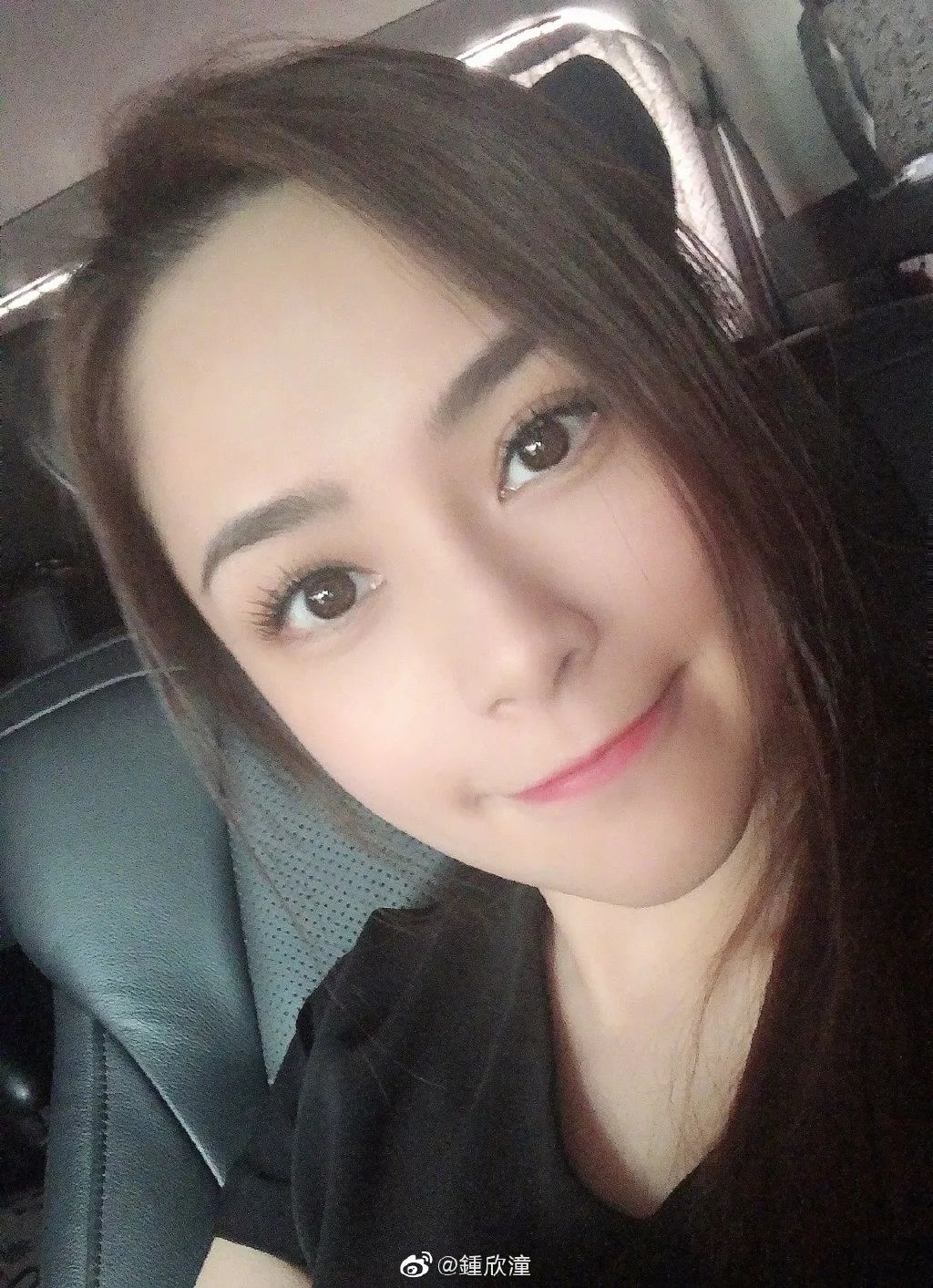 阿娇跌倒受伤,阿娇撞到额头