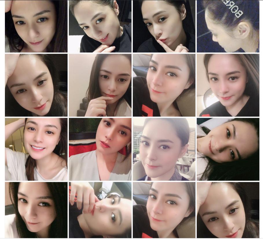 阿娇跌倒受伤,阿娇撞到额头