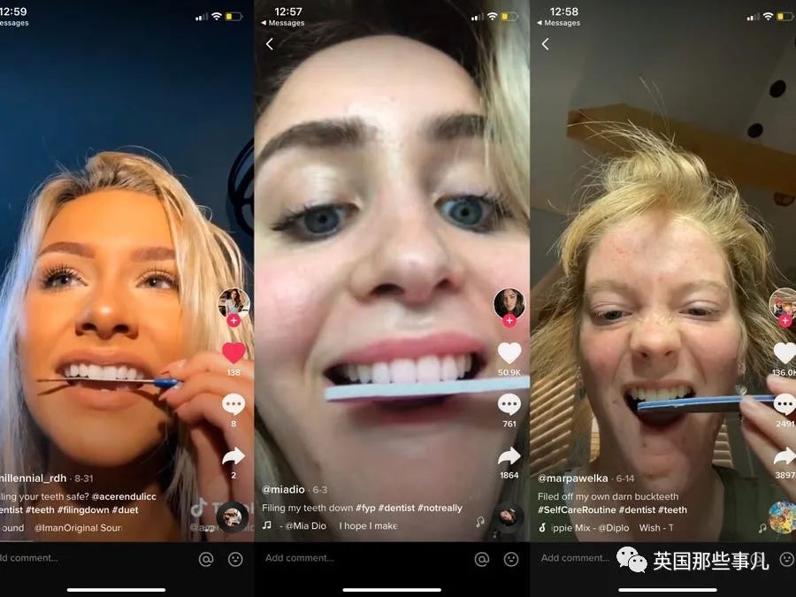 外网年轻人流行用指甲锉磨牙正畸,把正经牙医都急坏了