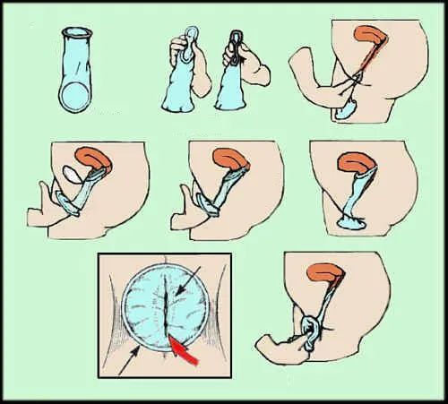 世界避孕日健康教育宣传,2019年世界避孕日主题