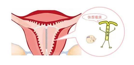 世界避孕日健康教育宣传,2019年世界避孕日主题