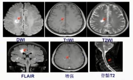 徐运神经内科,徐运医生怎么样