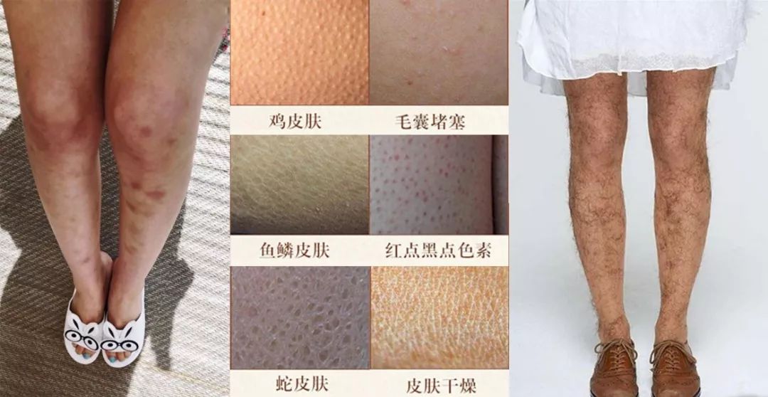 秋冬高级感穿搭粗腿,冬天怎么穿可以穿出37分