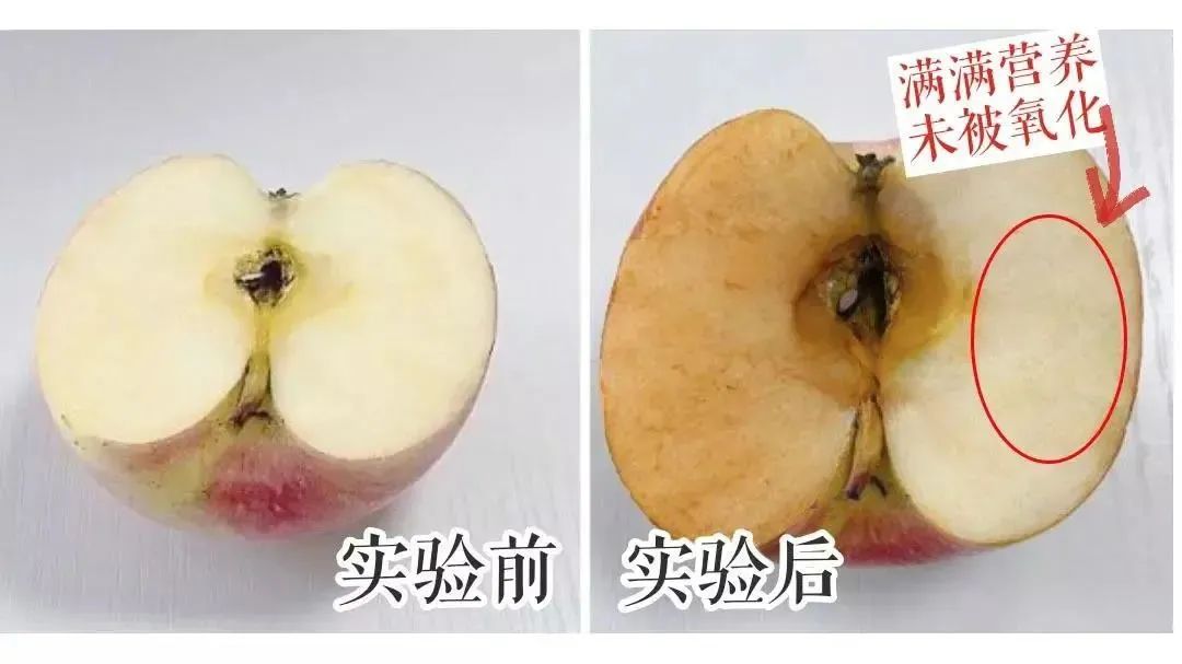 抬头纹眉间纹怎么去除,眉间纹抬头纹去除最好的方法