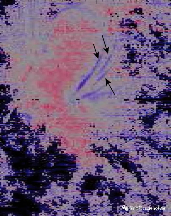 解开日冕之谜,解开日冕谜题