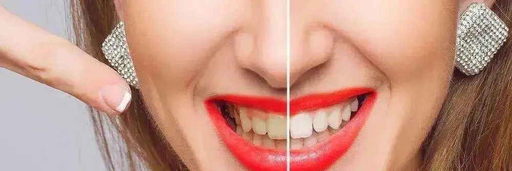 拿什么拯救你我的烂牙,拿什么拯救你的黄牙