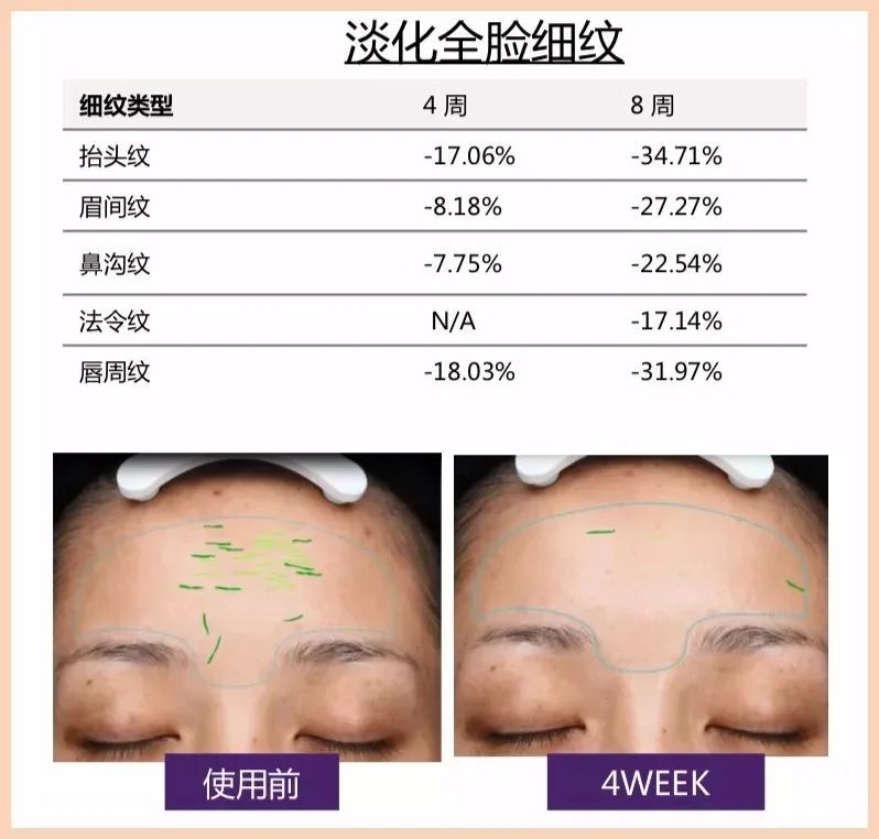 眼霜正品大品牌欧莱雅,眼霜欧莱雅紫熨斗正品