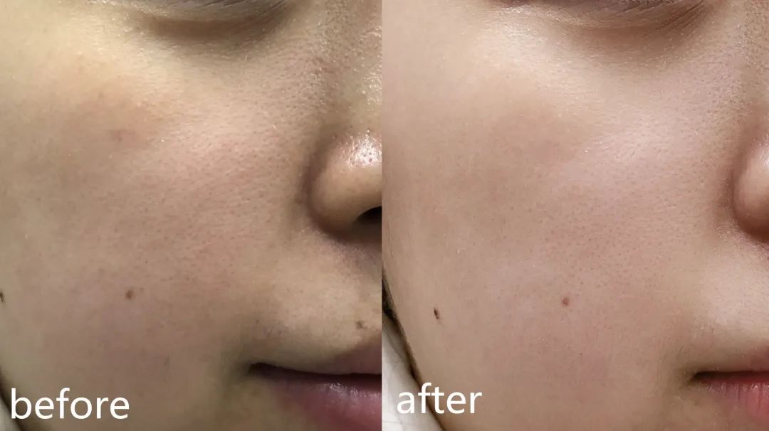 菲洛嘉柔润亮泽十全大补面膜50ml,菲洛嘉十全大补黑盖子